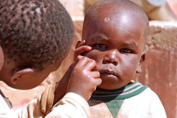 Niños africanos en Tanzania mientras te limpias la cara — Foto de Stock