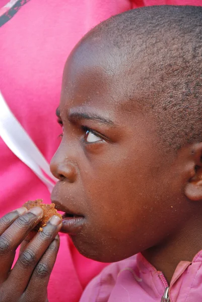 The skin of a child sick with AIDS — Stock Photo, Image