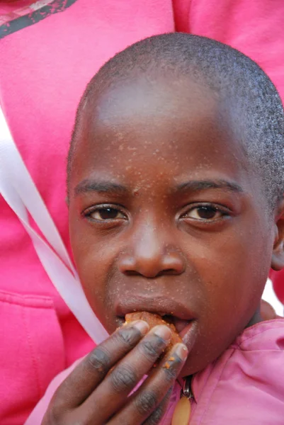 The skin of a child sick with AIDS — Stock Photo, Image