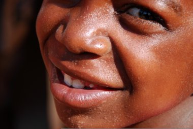 Afrikalı çocuklar tarafından kar amacı gütmeyen takip AIDS acı 