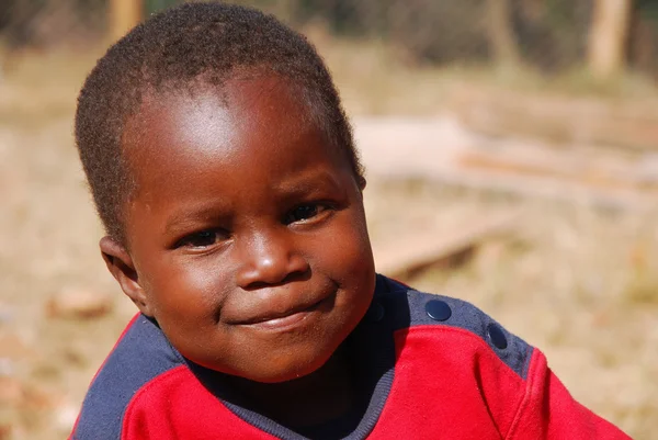 Los niños africanos que sufren de SIDA seguido por la organización sin fines de lucro — Foto de Stock