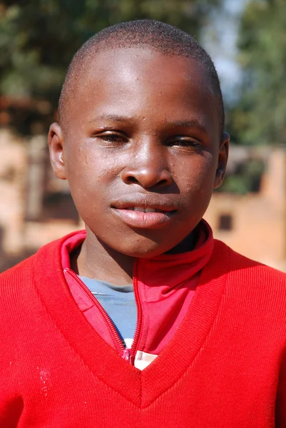 Los niños africanos que sufren de SIDA seguido por la organización sin fines de lucro — Foto de Stock