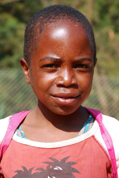 Los niños africanos que sufren de SIDA seguido por la organización sin fines de lucro — Foto de Stock