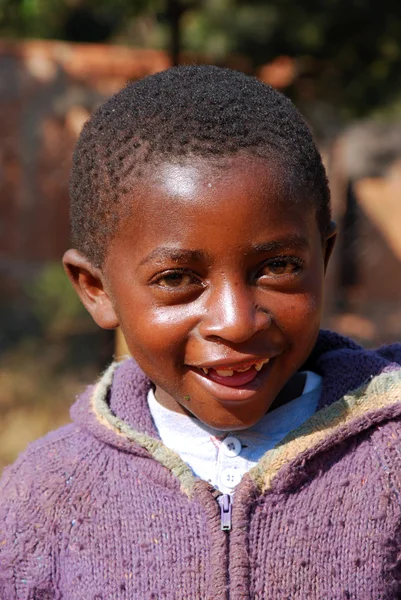 Los niños africanos que sufren de SIDA seguido por la organización sin fines de lucro — Foto de Stock