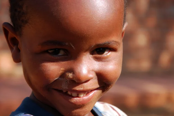 African children suffering from AIDS followed by the non-profit — Stock Photo, Image