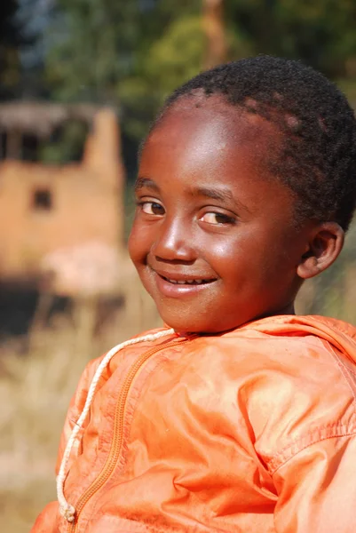 Los niños africanos que sufren de SIDA seguido por la organización sin fines de lucro — Foto de Stock