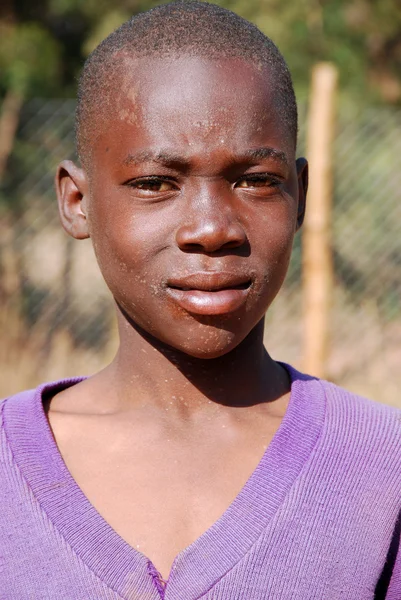 Afrikaanse kinderen die lijden aan Aids gevolgd door de non-profit — Stockfoto