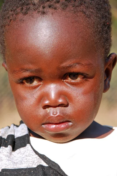 Африканские дети, страдающие СПИДом, за которыми следует некоммерческая организация — стоковое фото