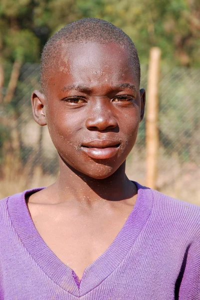 Afrikanska barn lider av Aids följt av den ideella — Stockfoto