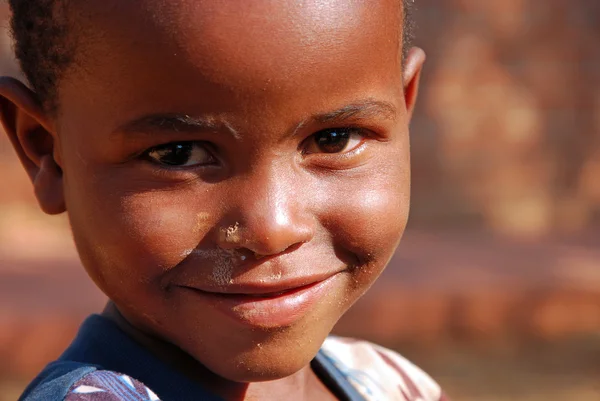 Los niños africanos que sufren de SIDA seguido por la organización sin fines de lucro —  Fotos de Stock