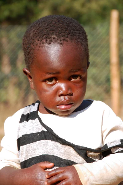African children suffering from AIDS followed by the non-profit — Stock Photo, Image
