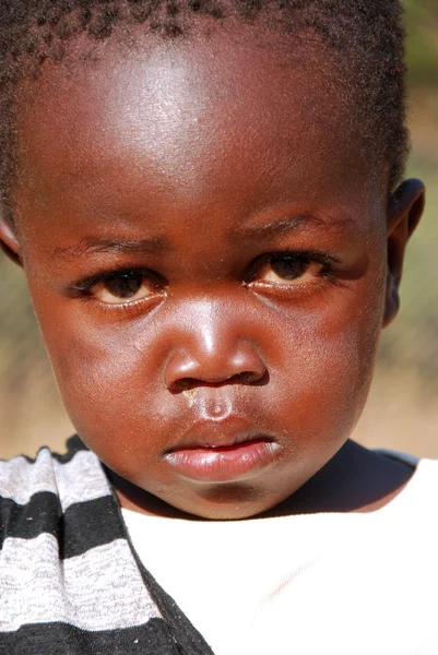 African children suffering from AIDS followed by the non-profit — Stock Photo, Image