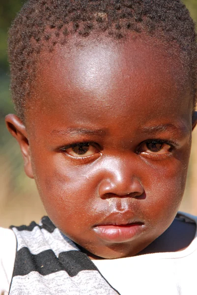 Los niños africanos que sufren de SIDA seguido por la organización sin fines de lucro — Foto de Stock