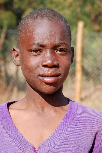 Afrikalı çocuklar tarafından kar amacı gütmeyen takip AIDS acı 