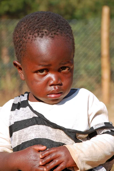 Crianças africanas que sofrem de SIDA, seguidas das sem fins lucrativos — Fotografia de Stock
