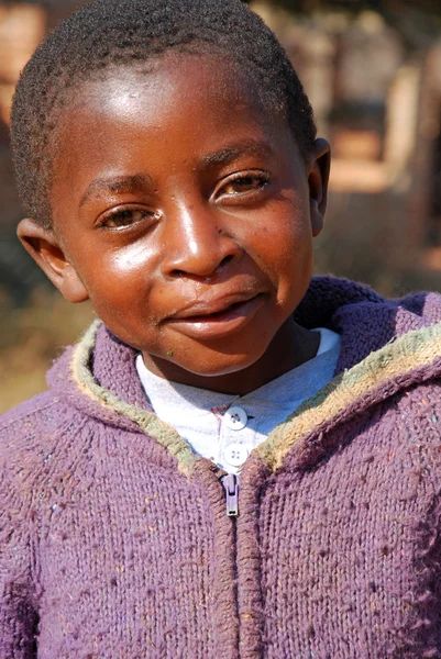 Los niños africanos que sufren de SIDA seguido por la organización sin fines de lucro —  Fotos de Stock