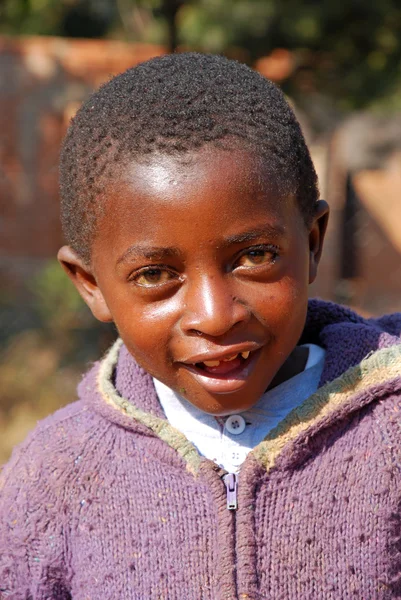 एड्स से पीड़ित अफ्रीकी बच्चों के बाद गैर-लाभकारी — स्टॉक फ़ोटो, इमेज