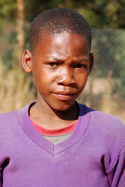아프리카 어린이 에이즈 비영리 뒤에서 고통 — 스톡 사진