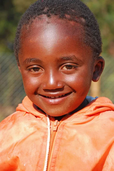 African children suffering from AIDS followed by the non-profit — Stock Photo, Image