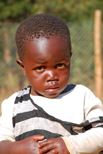 Африканським дітям, які страждають від СНІДу, слідують в некомерційних — стокове фото