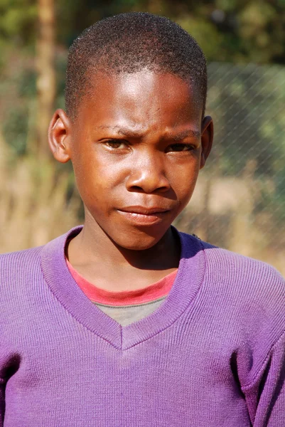 African children suffering from AIDS followed by the non-profit — Stock Photo, Image