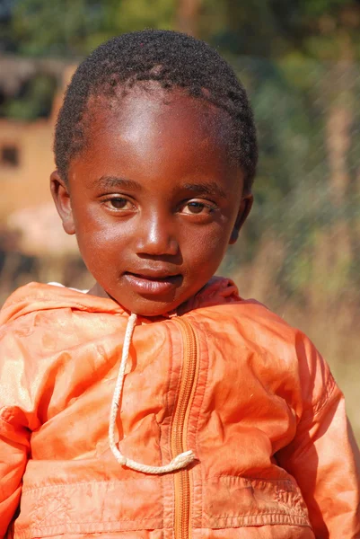 Los niños africanos que sufren de SIDA seguido por la organización sin fines de lucro —  Fotos de Stock