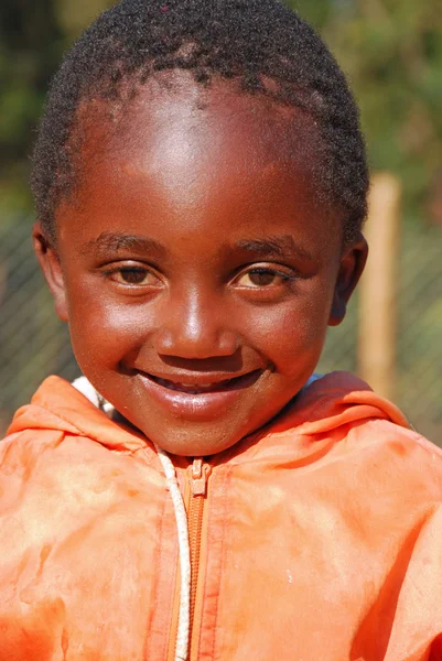 Afrikanische Kinder, die an Aids leiden, gefolgt von Non-Profit-Organisationen — Stockfoto