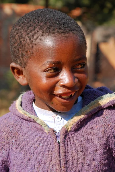 Los niños africanos que sufren de SIDA seguido por la organización sin fines de lucro — Foto de Stock