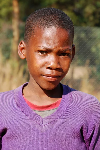 African children suffering from AIDS followed by the non-profit — Stock Photo, Image