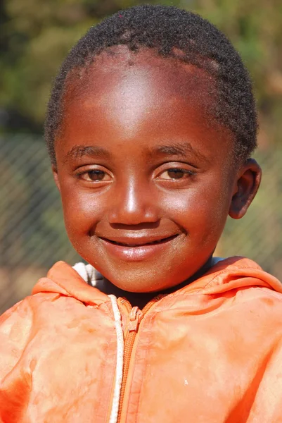 Los niños africanos que sufren de SIDA seguido por la organización sin fines de lucro —  Fotos de Stock