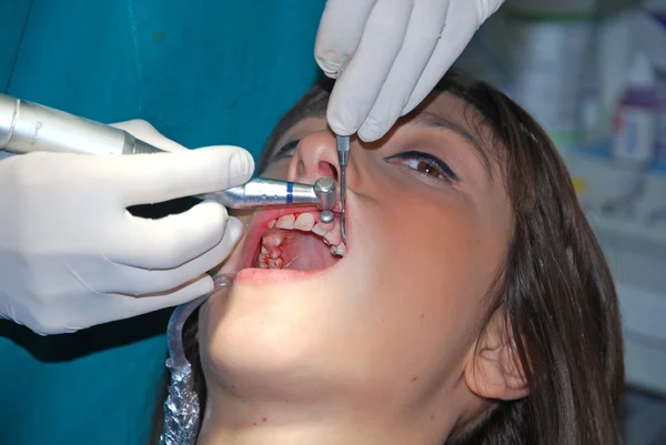 Cuidado dental - Una niña en el dentista — Foto de Stock