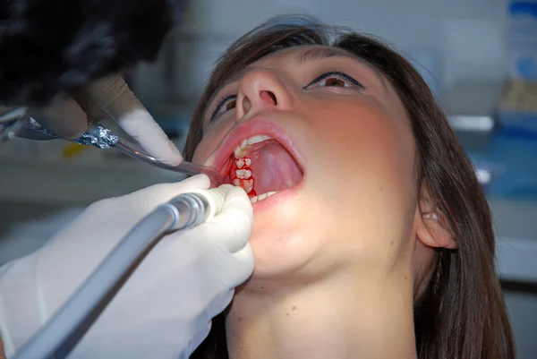 Dental Care - Uma menina no dentista — Fotografia de Stock