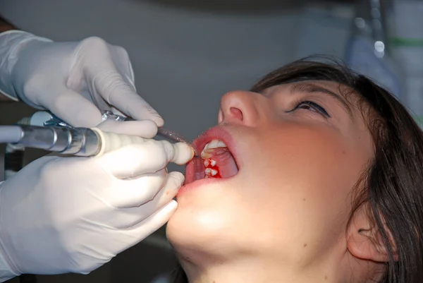 Cura dentale - Una ragazza dal dentista — Foto Stock