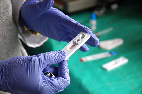 Test HIV a Pomerini in Tanzania - Africa — Foto Stock