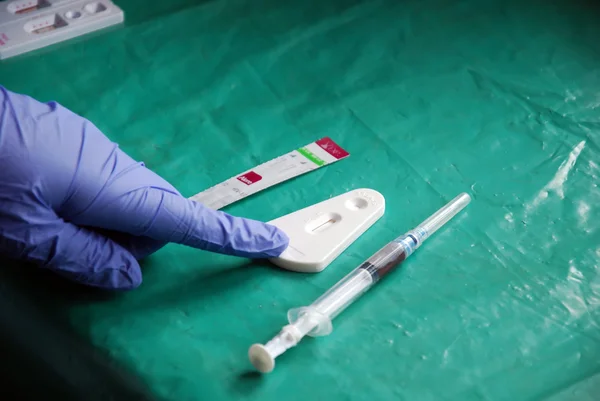 Análisis de laboratorio del virus del SIDA en Pomerini Village en Tan — Foto de Stock