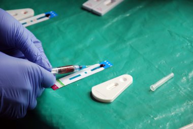 Pomerini Köyü Tanzanya - Afrika AIDS virüsü laboratuvar analizi