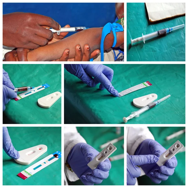 Processo di analisi del virus HIV nel laboratorio dell'ospedale di Pomerini - Africa — Foto Stock