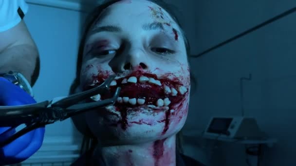 Uma Mulher Imagem Mutante Sangrento Arranca Dente Clínica Dentária Moderna — Vídeo de Stock