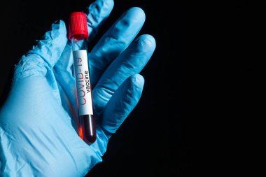 Tıbbi eldiven verin. Coronavirus Covid-19 aşı şişesi, yakın çekim detayları.
