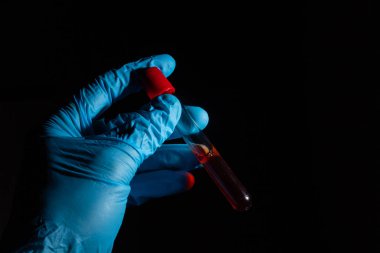 Doktor elinde COVID 19 Coronavirus aşısı tutuyor, örnek tüpte kan örneği, aşı ve şırınga enfeksiyonu COVID-19 'dan korunma, aşılama ve tedavi için kullanılıyor.