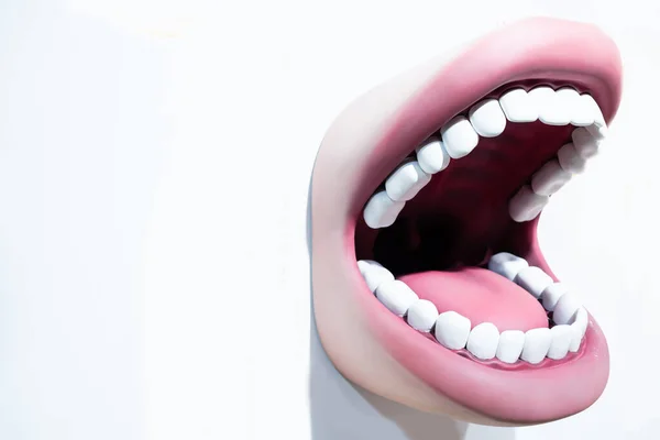 Fogsor az alsó és felső állkapocs a fogászati modell a harapás — Stock Fotó