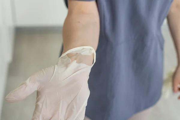 Gebruikte handschoen met een gat in de hand van de arts. — Stockfoto