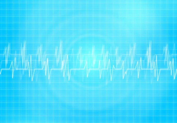 Digitale hart cardiogram — Stockfoto