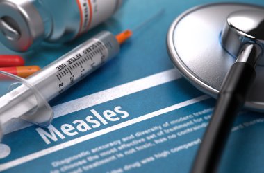 Measles. Medical Concept on Blue Background.