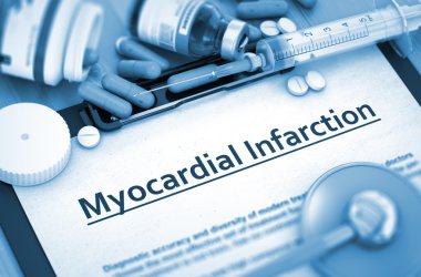 Myocardial Infarction Diagnosis. Medical Concept. clipart