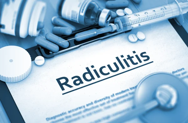 Diagnóstico de Radiculitis. Concepto médico . —  Fotos de Stock