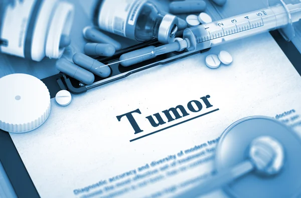Diagnóstico de tumores. Concepto médico. 3D . —  Fotos de Stock