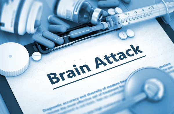 Diagnóstico de ataque cerebral. Concepto médico . — Foto de Stock