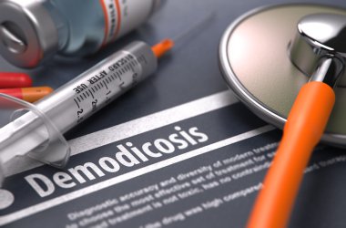 Demodikoz - Gri Arka Planda Baskılı Tanı.