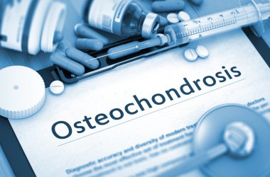 Osteochondrosis tanı. Tıp kavramı.